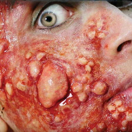 Tinsley Transfers Prosthetics Outbreak 5 Tinsley Transfers Prosthetics Outbreak