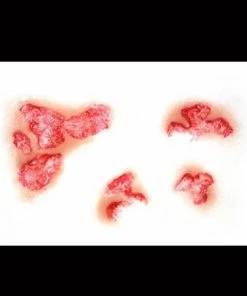 Tinsley Transfers Prosthetics Burned Flesh