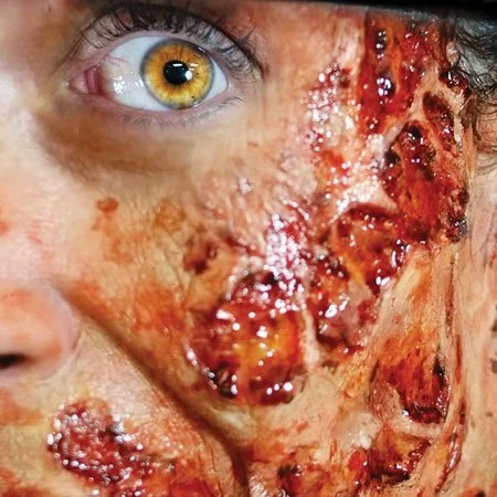 Tinsley Transfers Prosthetics Burned Flesh 5 Tinsley Transfers Prosthetics Burned Flesh