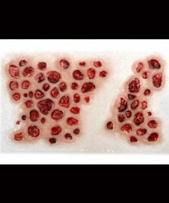 Tinsley Transfers Trypophobia