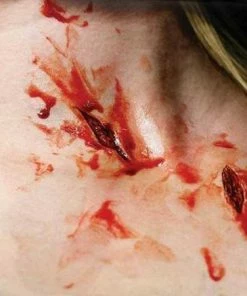 Tinsley Transfers Prosthetics Shanked