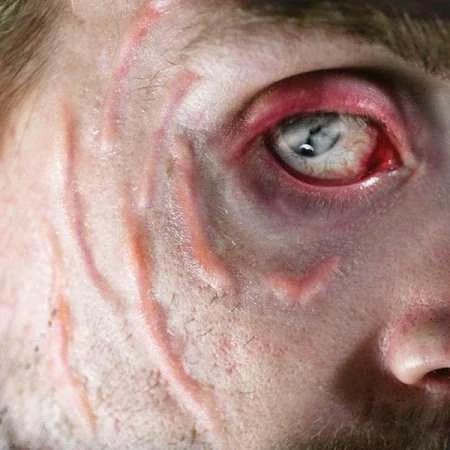 Tinsley Transfers Scarred 5 Tinsley Transfers Scarred