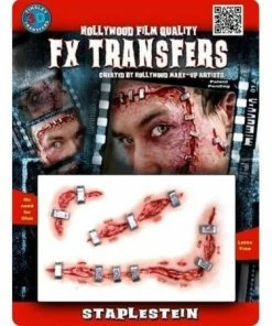 Tinsley Transfers Staplestein Prosthetics