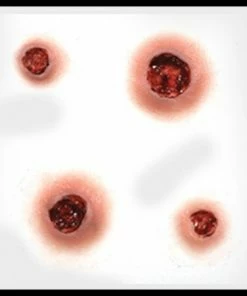 Tinsley Transfers Prosthetics Capped