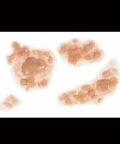 Tinsley Transfers Prosthetics Outbreak