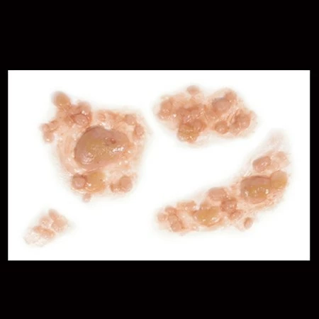 Tinsley Transfers Prosthetics Outbreak 4 Tinsley Transfers Prosthetics Outbreak